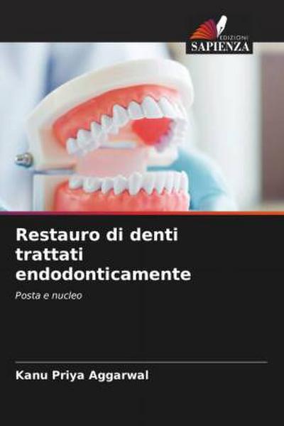 Restauro di denti trattati endodonticamente