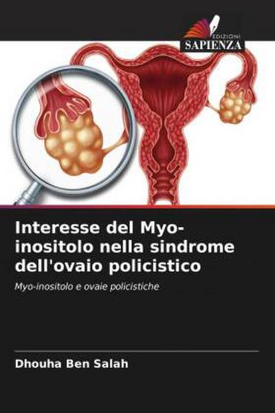 Interesse del Myo-inositolo nella sindrome dell’ovaio policistico