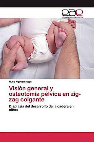 Visión general y osteotomía pélvica en zig-zag colgante