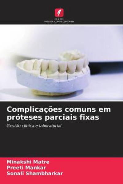 Complicações comuns em próteses parciais fixas