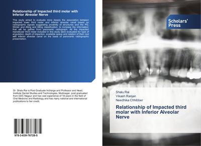 Relationship of Impacted third molar with Inferior Alveolar Nerve
