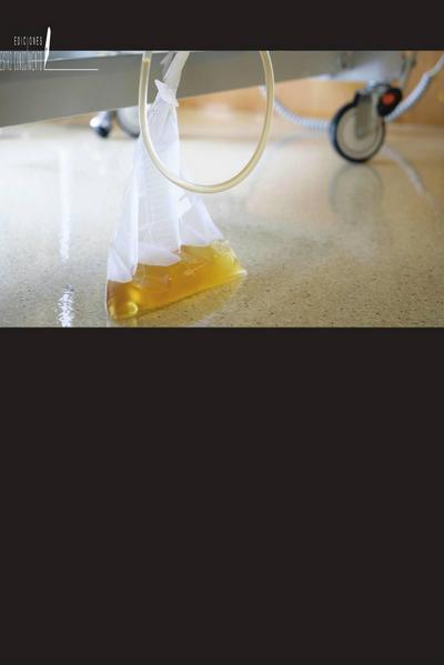 Minimizar la carga microbiana en los catéteres urinarios