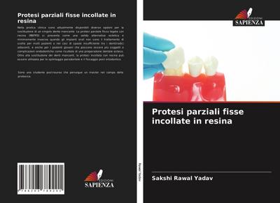 Protesi parziali fisse incollate in resina