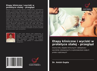 Etapy kliniczne i wyciski w protetyce sta¿ej - przegl¿d