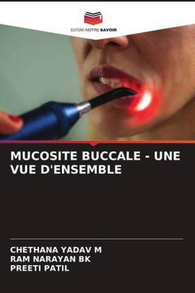 MUCOSITE BUCCALE - UNE VUE D’ENSEMBLE