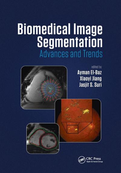 Biomedical Image Segmentation