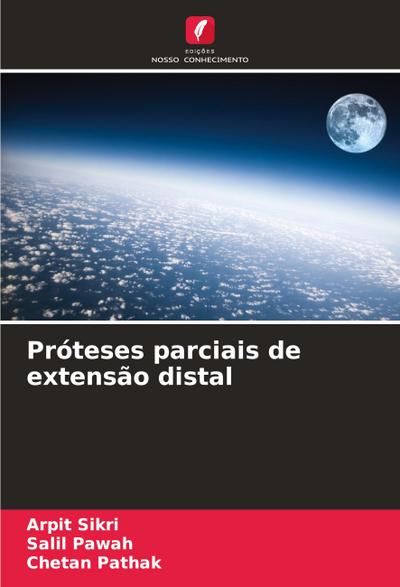 Próteses parciais de extensão distal
