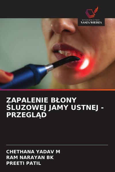 ZAPALENIE B¿ONY ¿LUZOWEJ JAMY USTNEJ - PRZEGL¿D