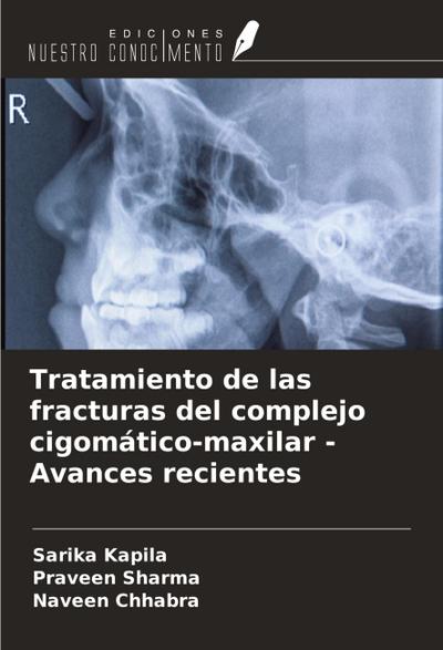 Tratamiento de las fracturas del complejo cigomático-maxilar - Avances recientes