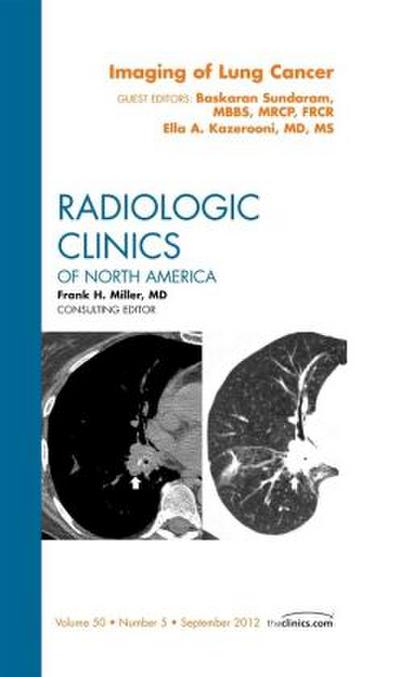 Imaging of Lung Cancer, an Issue of Radiologic Clinics of North America