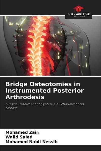 Bridge Osteotomies in Instrumented Posterior Arthrodesis