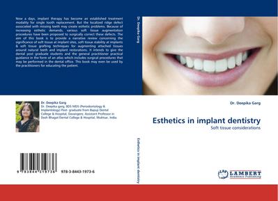 Esthetics in implant dentistry