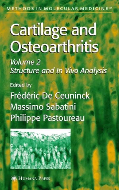Cartilage and Osteoarthritis