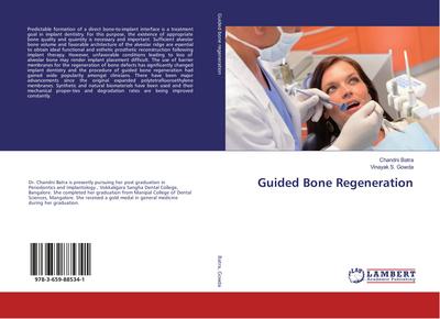 Guided Bone Regeneration