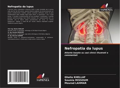 Nefropatia da lupus