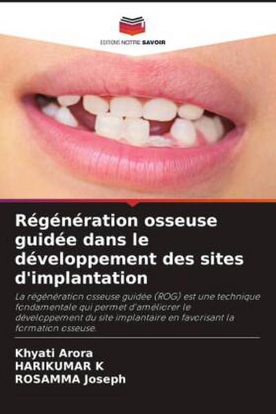 Régénération osseuse guidée dans le développement des sites d’implantation