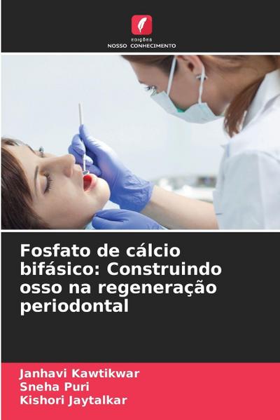 Fosfato de cálcio bifásico: Construindo osso na regeneração periodontal
