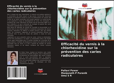 Efficacité du vernis à la chlorhexidine sur la prévention des caries radiculaires