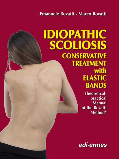 Idiopathic Scoliosis (P)