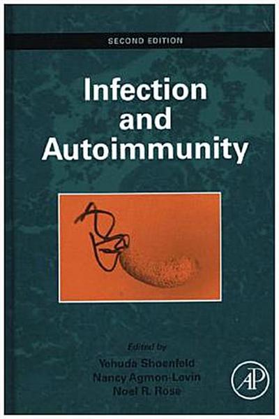 Infection and Autoimmunity