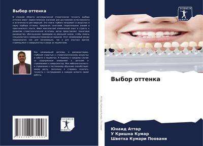 Vybor ottenka