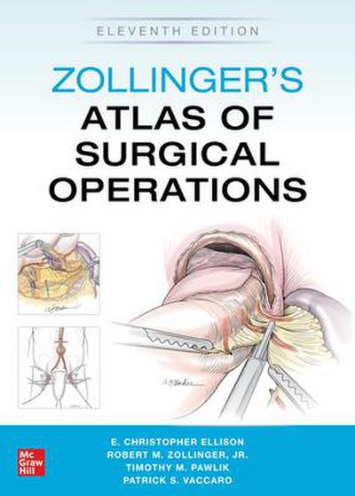 Zollinger’s Atlas of Surgical Operations, Eleventh Edition