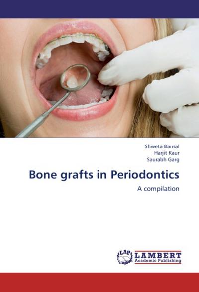 Bone grafts in Periodontics