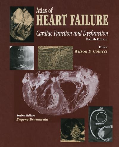 Atlas of HEART FAILURE