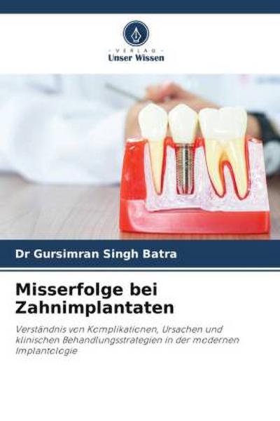 Misserfolge bei Zahnimplantaten