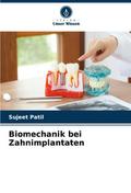 Biomechanik bei Zahnimplantaten