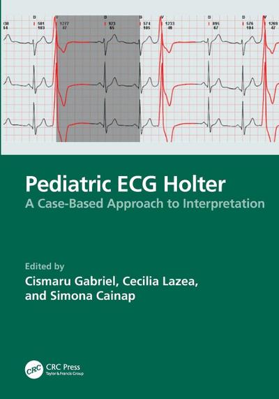Pediatric ECG Holter