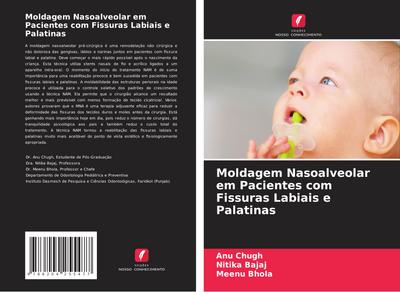 Moldagem Nasoalveolar em Pacientes com Fissuras Labiais e Palatinas