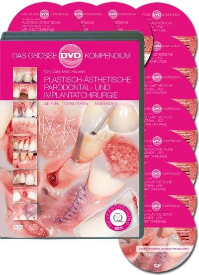 Plastisch-Ästhetische Parodontal- und Implantatchi Plastisch-Ästhetische Parodontal- und Implantatchirurgie, 10 DVD-Videos