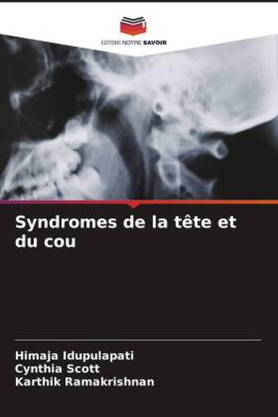 Syndromes de la tête et du cou