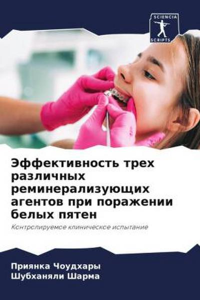 Jeffektiwnost’ treh razlichnyh remineralizuüschih agentow pri porazhenii belyh pqten