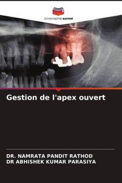 Gestion de l’apex ouvert