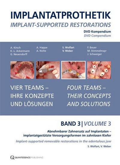 Implantatprothetik. DVD, Band 3
