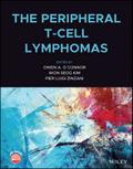 The Peripheral T-Cell Lymphomas