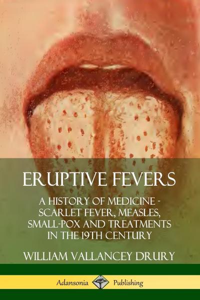 Eruptive Fevers