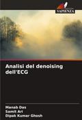 Analisi del denoising dell’ECG