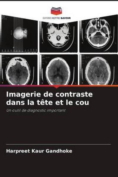 Imagerie de contraste dans la tête et le cou