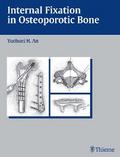 Internal Fixation in Osteoporotic Bone