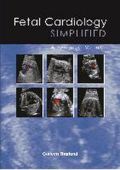 Fetal Cardiology Simplified