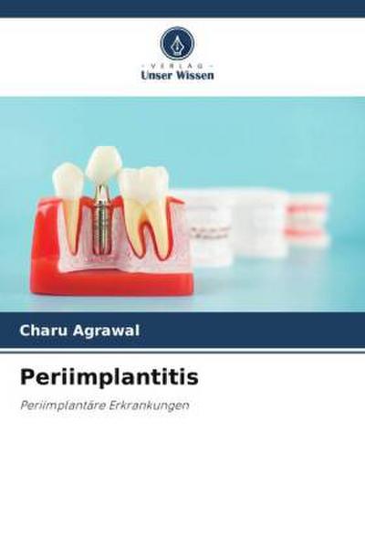 Periimplantitis
