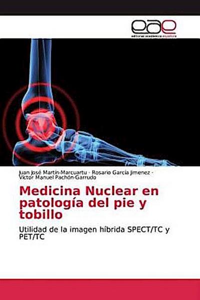 Medicina Nuclear en patología del pie y tobillo