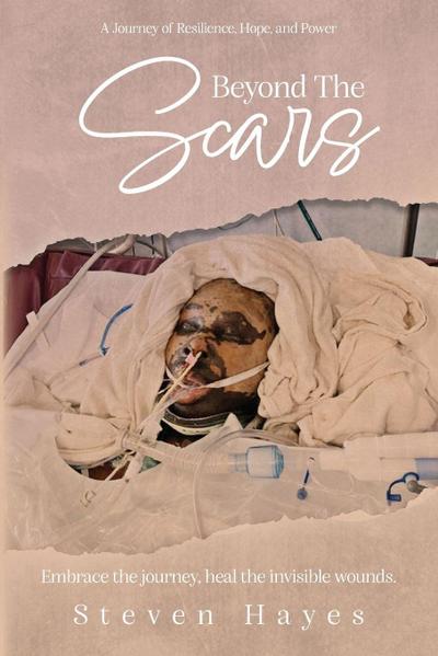 Beyond The Scars