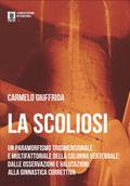 La Scoliosi
