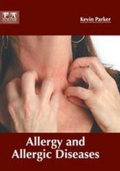 Allergy and Allergic Diseases