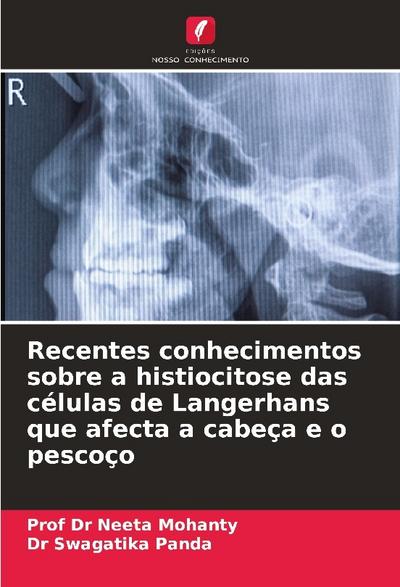 Recentes conhecimentos sobre a histiocitose das células de Langerhans que afecta a cabeça e o pescoço