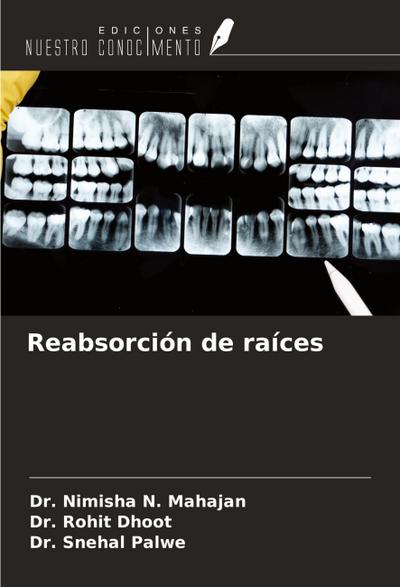 Reabsorción de raíces
